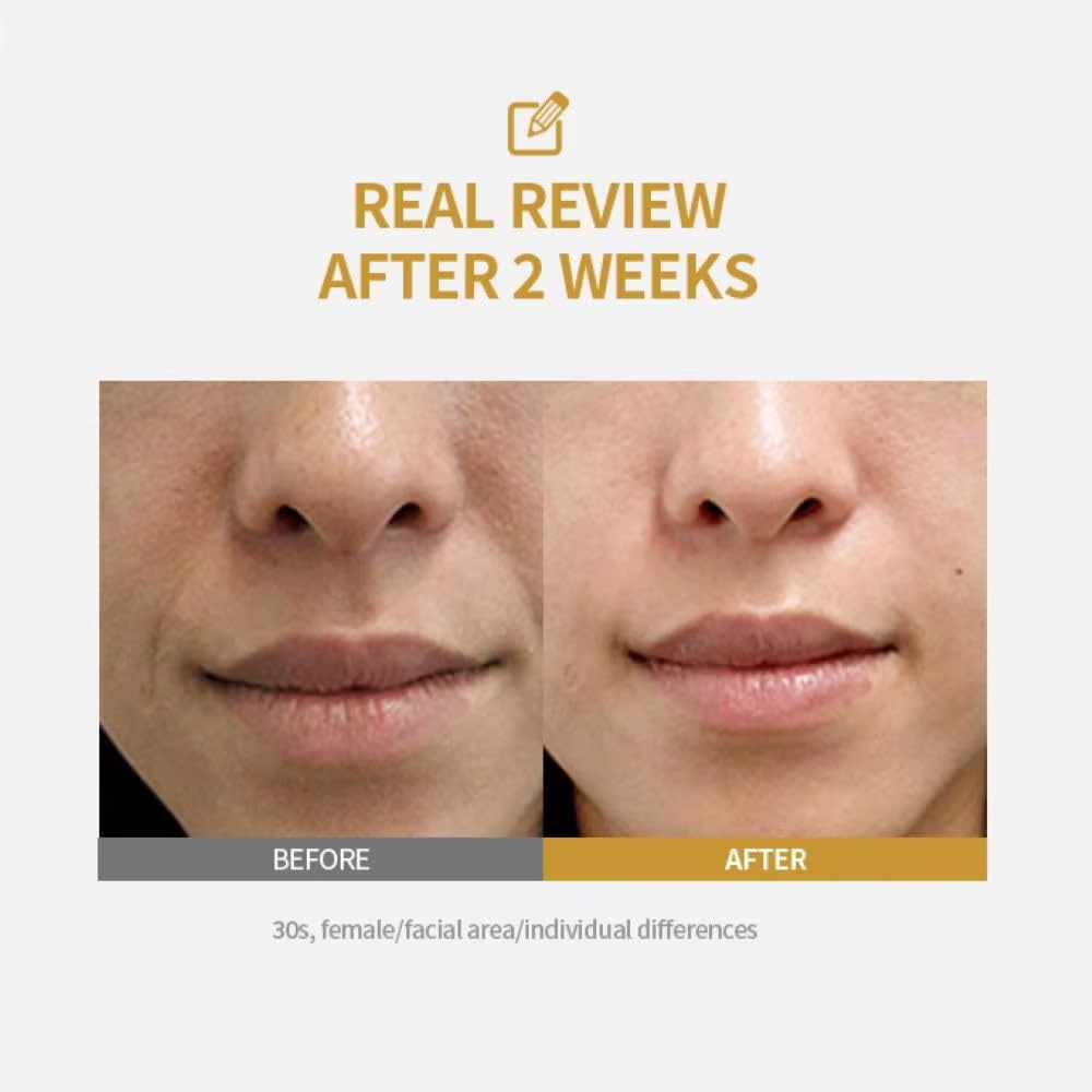 Peptid-Intensiv-Lifting-Ampull – Collagen Peptide Powder Bewertung und Preis